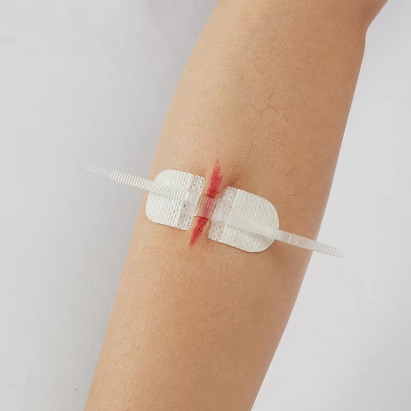 Skin Adhesive Practice Kit