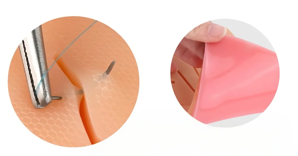 Suture pad detail